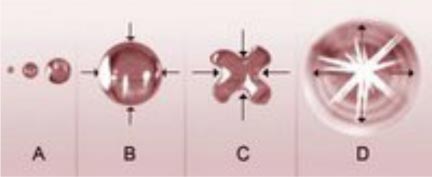 ultrasonoids cavitation